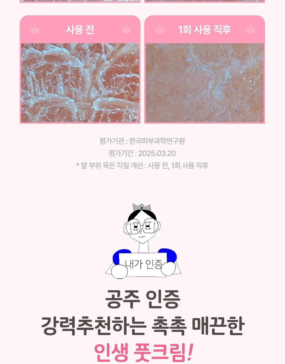 [매끈발템/올인원풋케어] 플루 퍼펙트 발 각질 케어 세트 (발각질 제거기+크림) 상세페이지 22